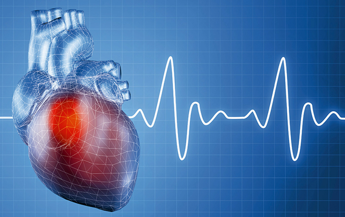 سکته قلبی چیست و اقدامات درمانی